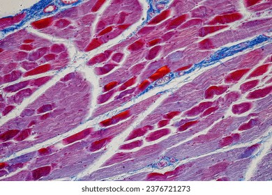 Showing Light micrograph Type of Tissue Human under the microscope in Lab.