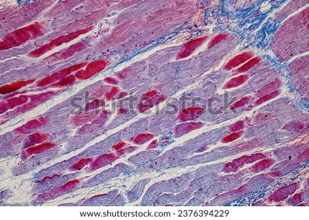 Showing Light micrograph Type of Tissue Human under the microscope in Lab.
