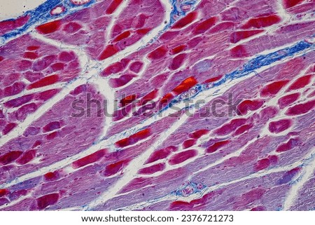 Showing Light micrograph Type of Tissue Human under the microscope in Lab.