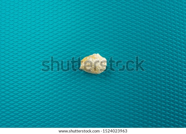 Sialolithiasis Salivary Duct Stone On Blue Stock Photo 1524023963 ...