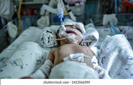 care of baby in ventilator