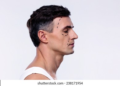 Side View Portrait Of A Man Marked With Lines For Plastic Surgery