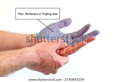Signs of carpal tunnel syndrome in man, showing are of pain, numbness or tingling. 