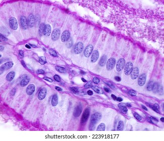 Simple Columnar Epithelium Of Gallbladder Stained With PAS Method. The Striated Border, Basement Membrane, And Cytoplasmic Granules Are PAS +. Light Microscope Picture 