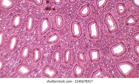 Simple Columnar Epithelium. Light Micrograph Of A Renal Medulla Showing Several Collecting Ducts Lined By A Simple Columnar Epithelium. 