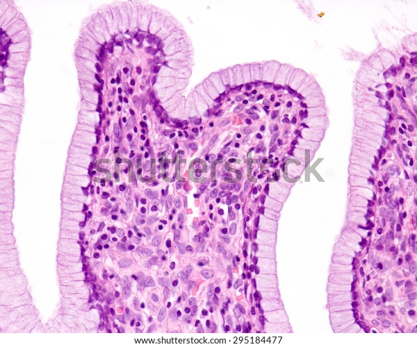 Simple Columnar Epithelium Uterine Cervix Epithelium Stock Photo Edit Now 295184477