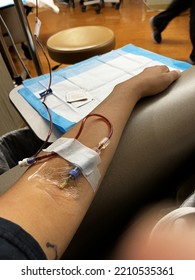 A Simple Iron Infusion For Low Hemoglobin. An IV To Bring It To Your Arm