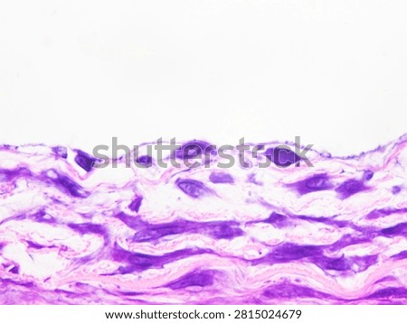 Simple squamous epithelium is a type of covering epithelium; those cells lining the inner surfaces of blood and lymphatic vessels are known as endothelial cells.Magnified 1000x
