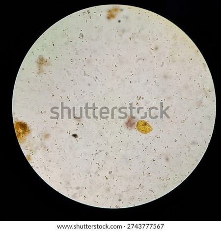 A single squamous epithelium in stool under high power findings 
