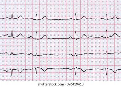 148 Qt interval Images, Stock Photos & Vectors | Shutterstock