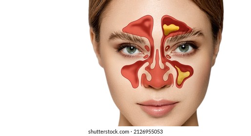 Sinusitis, frontitis. Female face with inflammation of mucous membrane of paranasal and frontal sinuses - Shutterstock ID 2126955053
