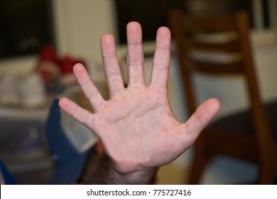 Six Fingers On A Hand