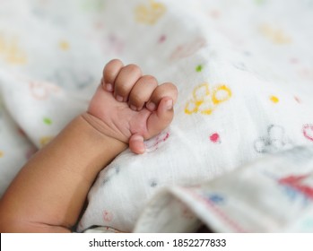 Six Fingers On Hand Of New Born Baby - Preaxial Polydactyly