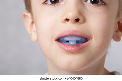 Six Years Old Boy Shows Myofunctional Trainer To Illuminate Mouth Breathing Habit.  Closeup