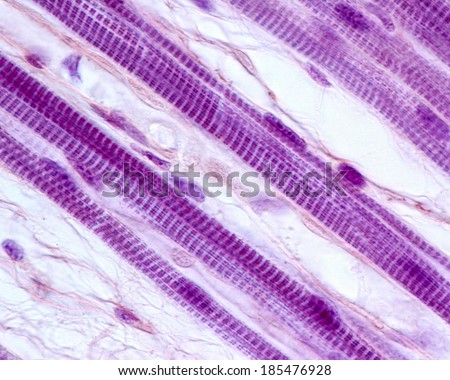 Skeletal muscle fibers showing striated myofibrils. Light microscope micrograph.