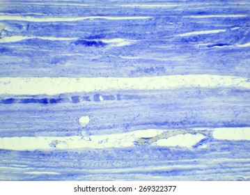 Skeletal Muscle Tissue Longitudinal Section Under A Microscope, Skeletal Muscle L.S., 400x