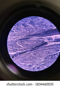 Skeletal Muscle Tissue (tongue), Comprised From A Series Of Bundles Of Muscle Fibers