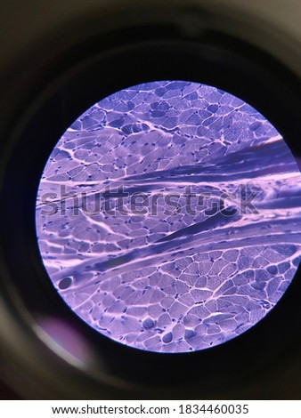 Skeletal muscle tissue (tongue), comprised from a series of bundles of muscle fibers