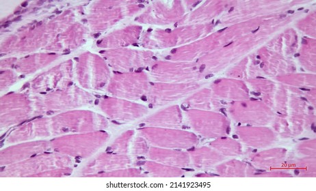 Skeletal striated muscle fibers in cross section showing the presence of several nuclei multinucleated cells located in the cell periphery. Light microscope photomicrograph. - Shutterstock ID 2141923495