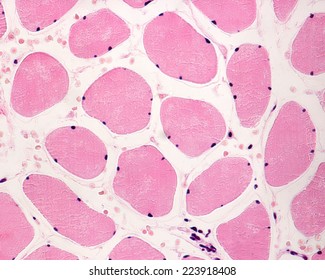Skeletal Striated Muscle Fibers In Cross Section Showing The Presence Of Several Nuclei (multinucleated Cells) Located In The Cell Periphery. Light Microscope Photomicrograph