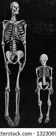 Skeleton Of A Giant And A Dwarf, Vintage Engraved Illustration. From The Universe And Humanity, 1910.
