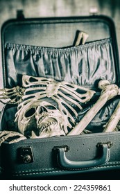 Skeleton in a Suitcase 1. Human skeleton bones and skull in a retro suitcase, with vintage photo filters applied.