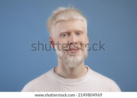Skin abnormality concept. Portrait of bearded handsome albino guy posing to camera over blue studio background. Man with pale skin and white hair
