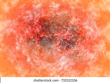 Skin Mole Stock Illustrations, Images & Vectors | Shutterstock