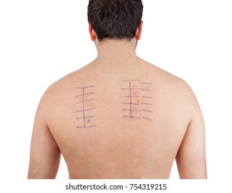 480 Skin Patch Test Images, Stock Photos & Vectors | Shutterstock