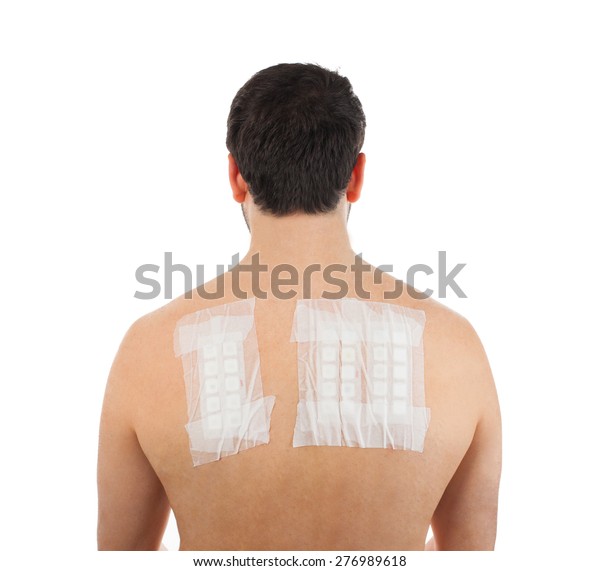 Skin Allergy Patch Test On Back Stock Photo (Edit Now) 276989618