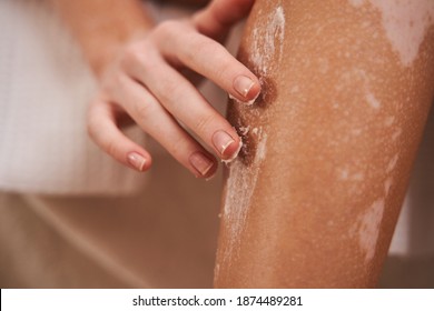 Skin Care. Close up of a perfect female legs with vitiligo. Woman applying moisturizer at her silk skin while sitting at home at the self isolation - Powered by Shutterstock