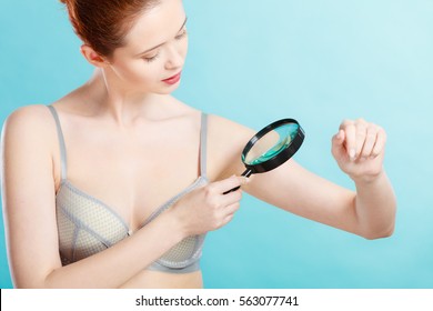 Skin Control Self Examination Concept. Yound Woman Holds Magnifying Glass In Hand Examining Her Body For Melanoma Suspicion. Checking Benign Moles.