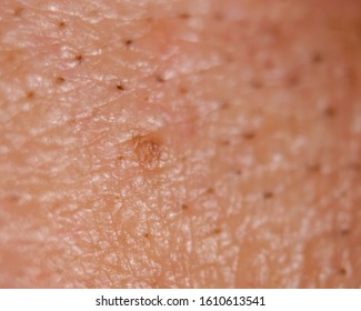 Skin Detail Blackheads Macro Stock Photo (Edit Now) 1610613541