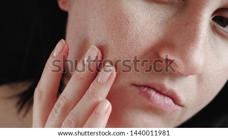 Skin with enlarged pores close-up. The woman touches the skin of her face, examining it.