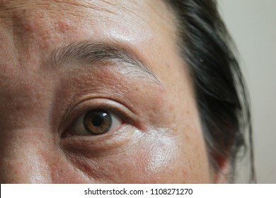 Skin face of asian woman 40s as under eye dark circles,as crow’s feet,and melasma freckles due to pigment melanin malfunction due to hormones or lack of care,wrinkle on face and of Middle aged woman.