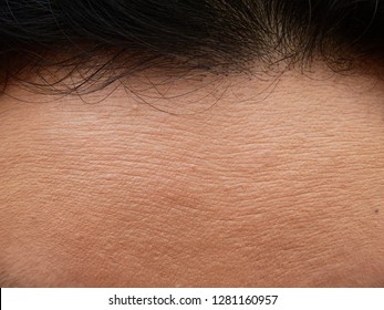 skin of forehead texture