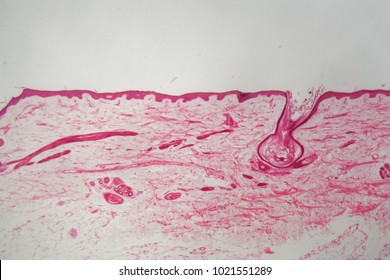 Skin With A Hair Follicle Under The Microscope.