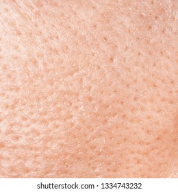 Skin Man Texture, Large Pores Close-up