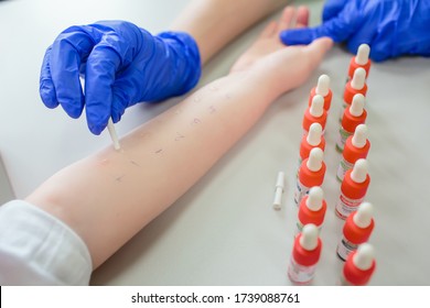 Skin Prick Allergy Testing For Children