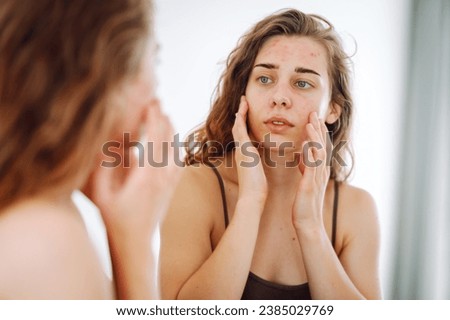 Skin problem. A beautiful woman touches her inflammation on her face while looking in the mirror in a bright room. Natural beauty. Medical care and treatment concept.