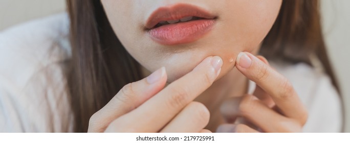 skin problem treatment. Women looking acne on her face in the mirror. - Shutterstock ID 2179725991
