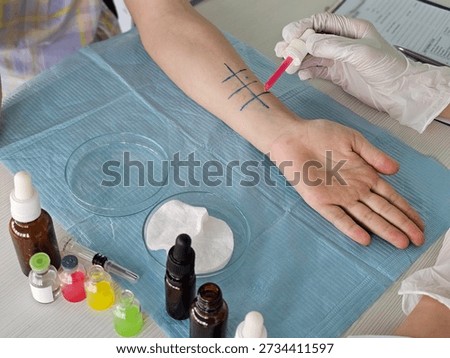 Skin test for allergies using colored liquids and marked grid on arm at a medical facility