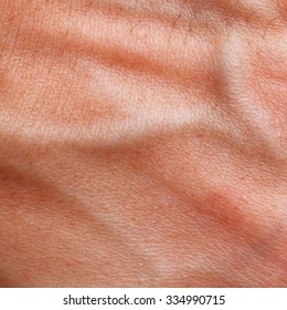 It is Skin texture with blood vessel and hair.