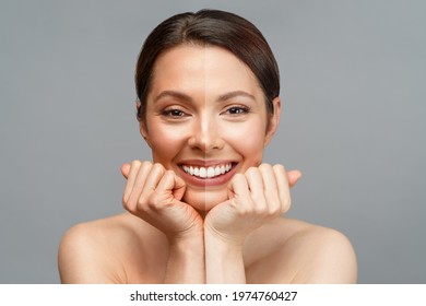 Skin whitening. A Latin American woman comparing half of her face with dark, tanned skin and half with light skin. The effect before and after bleaching or using sunscreen. - Shutterstock ID 1974760427