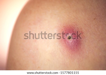 Similar – umbilicus Fluff Navel