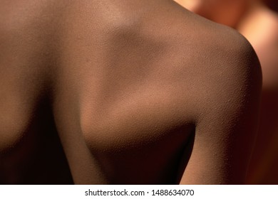 Skinny Guy With Protruding Scapula