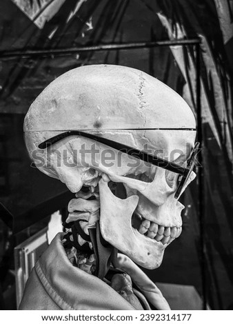 Skull with glasses. Skeleton head wearing glasses and a medical gown.