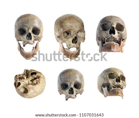 Skull of the person close-up on a white 
 background.