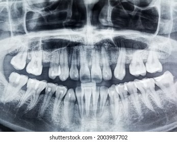 Skull Teeth Xrays Medical Imaging Stock Photo 2003987702 | Shutterstock