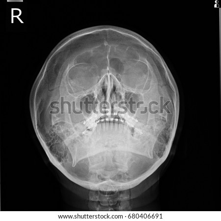 SKULL WATER VIEWS Xray Stock Photo (Edit Now) 680406691 - Shutterstock